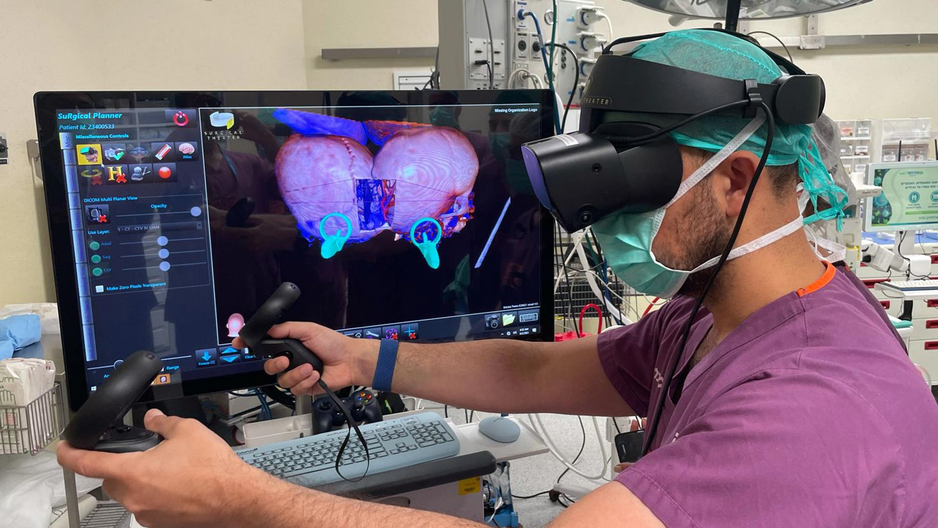 Rare Conjoined Twin Surgery Aided by VR Training, Bridging the Gap Between Two Continents – Road to VR